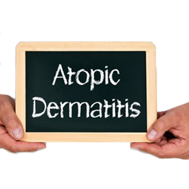  Dermatite Atopique 